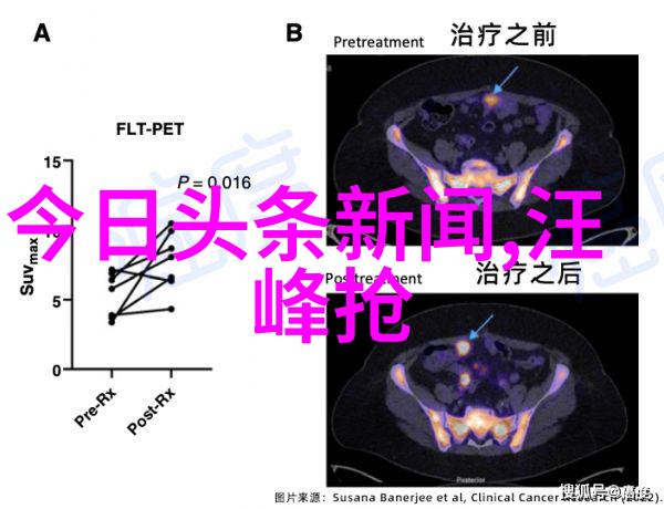 十九岁日本电影免费完整版观看-青春之翼十九岁的梦想与挑战